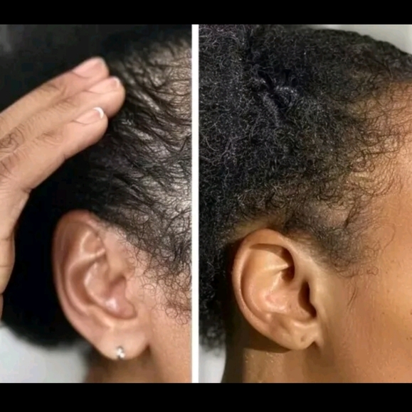 *:New Crown naturale Electric Scalp Massager Hair Oil Applicator Brush Red Light - Picture 9 of 16